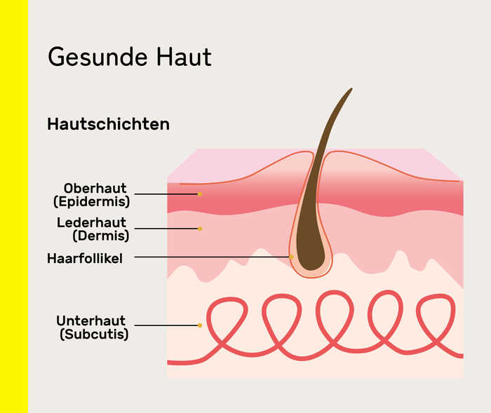 Akne inversa: Biologika Gesunde Haut