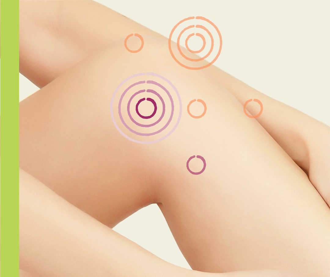 Nesselsucht-Symptome: Gelenkschwellung Ein angewinkeltes Knie. Rote Zielscheiben markieren verschiedene Stellen am Knie.