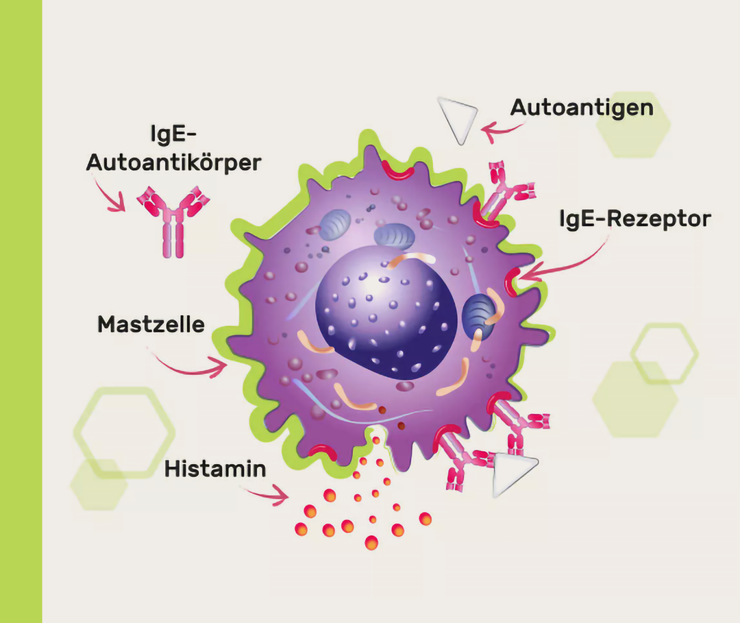 Nesselsucht-Ursachen: Infografik Aktivierung Mastzellen Infografik mit einer Mastzelle und den dort stattfindenden Abläufen bei der Freisetzung von Histamin sowie die daran beteiligten IgE-Antikörper, IgE-Rezeptoren und Autoantigene.