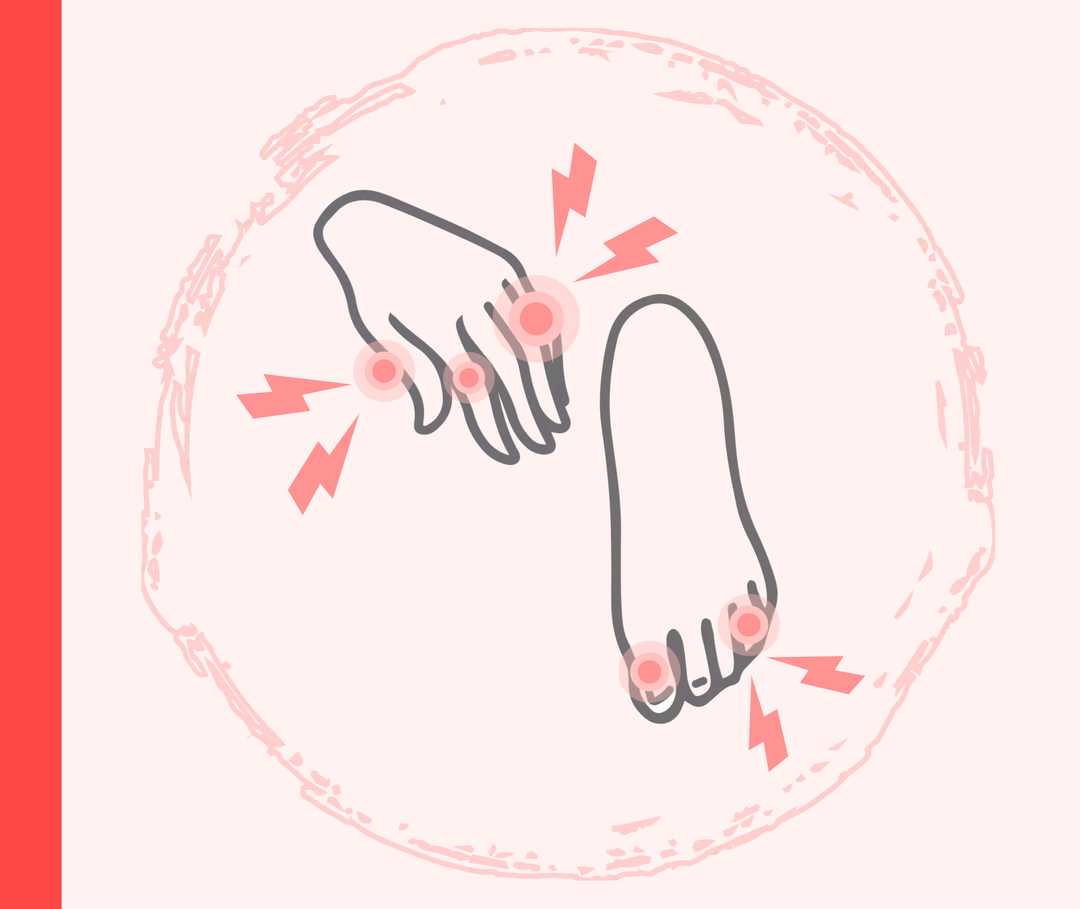 Psoriasis-Arthritis an Finger- und Zehengelenken Grafik einer Hand und eines Fußes mit roten Markierungen und Blitzen, die die schmerzenden Gelenke darstellen sollen.
