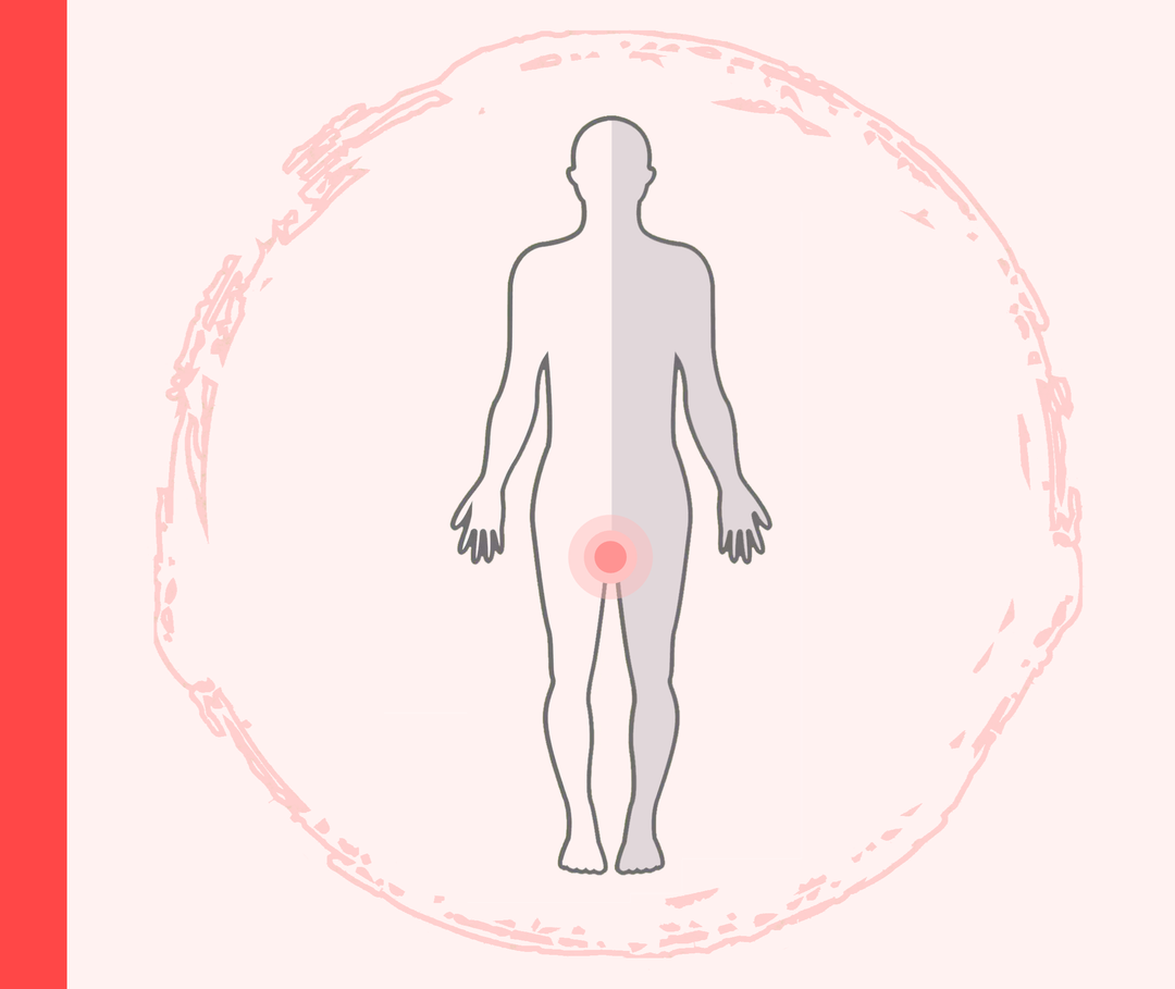 Psoriasis im Intimbereich Umriss einer Person mit oranger Markierung im Intimbereich.