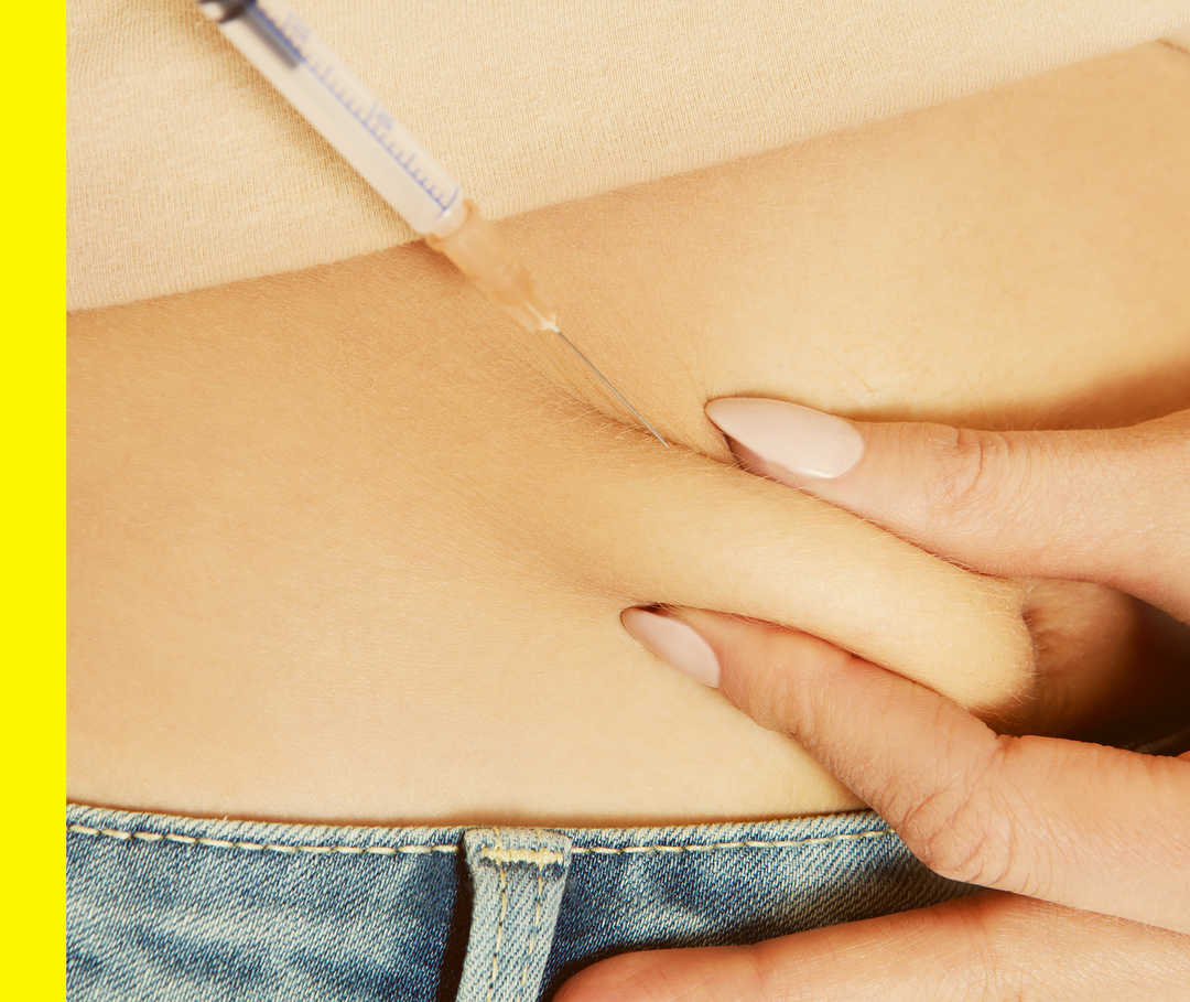 Akne inversa: Systemische Medikamente Eine Patientin gibt sich eine Spritze in den Unterbauch