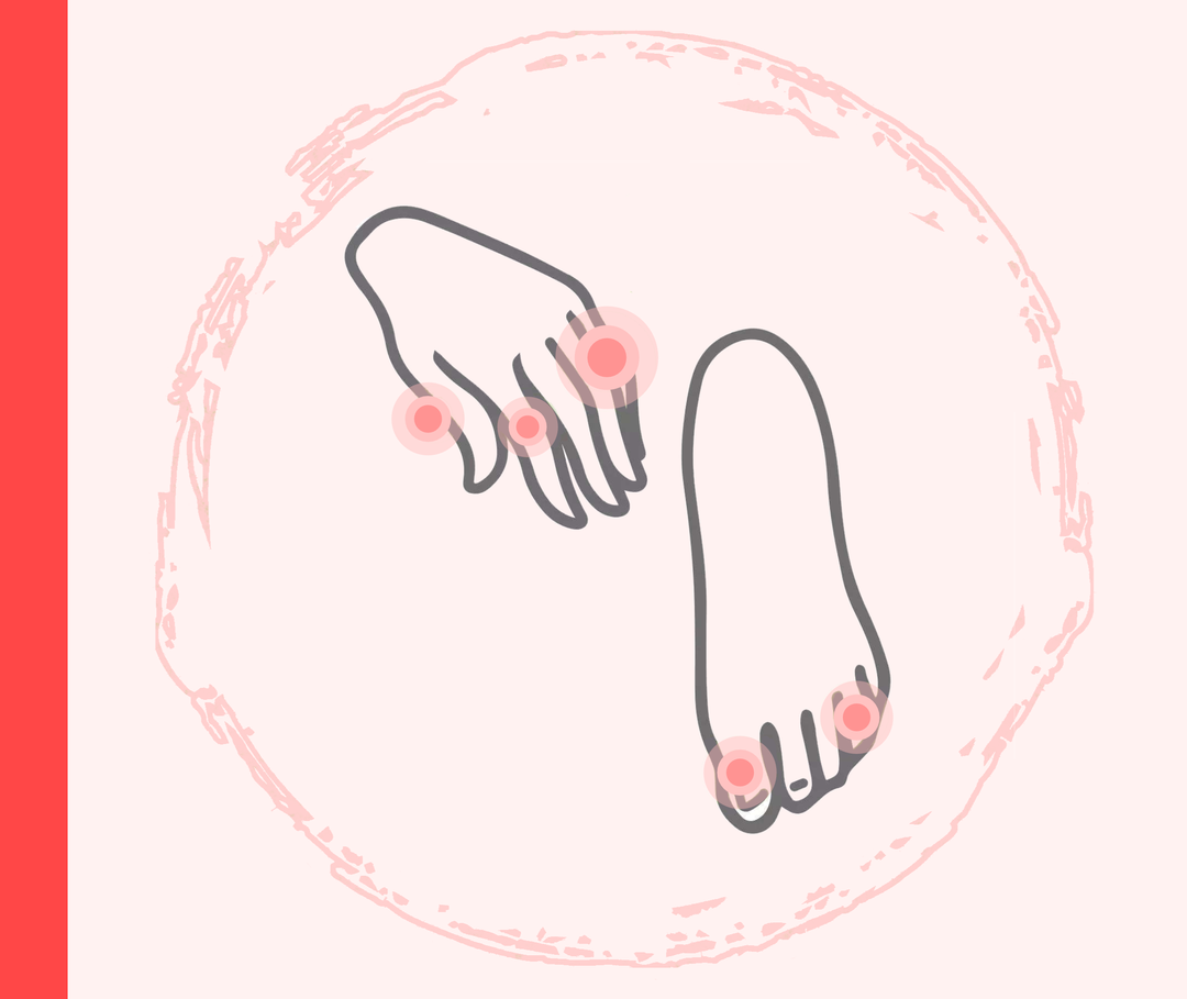Psoriasis-Arthritis an Finger- und Zehengelenken Grafik einer Hand und eines Fußes mit grünen Markierungen im Bereich der Gelenke, die die Psoriasis-Arthritis darstellen sollen.