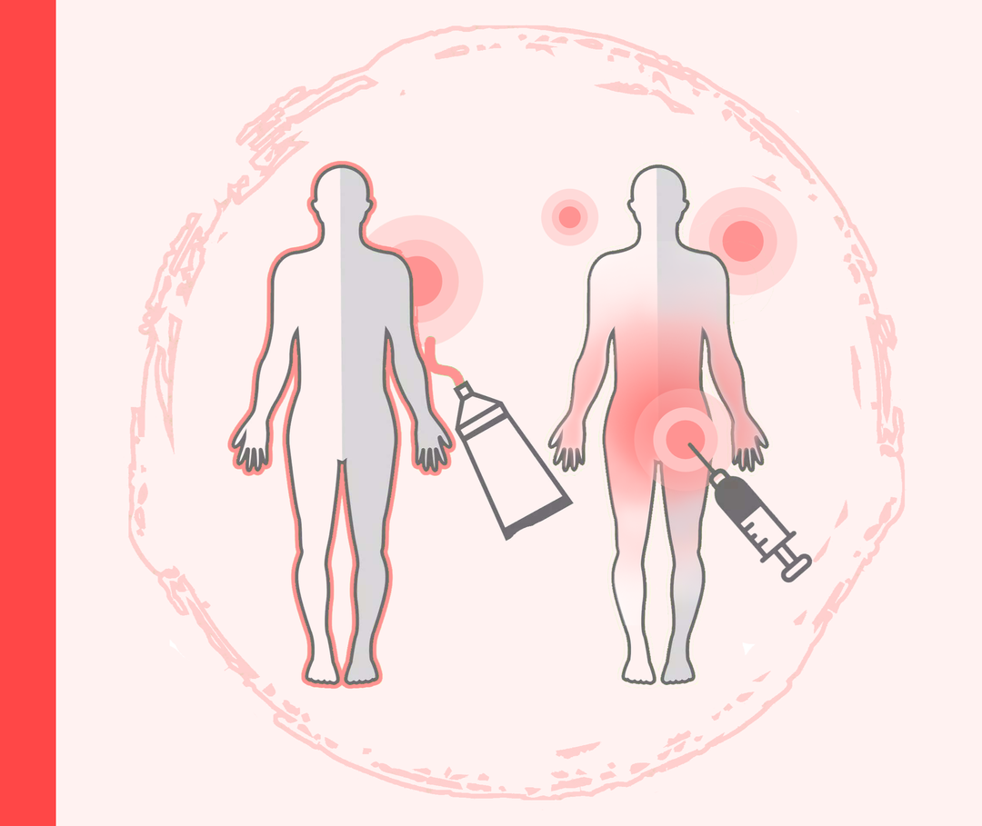 Nagelpsoriasis: Äußerliche und innerliche Behandlung Umrisse zweier Personen mit rotenen Markierungen. Neben der einen Person ist eine stilisierte Cremetube platziert, neben der anderen eine Spritze.
