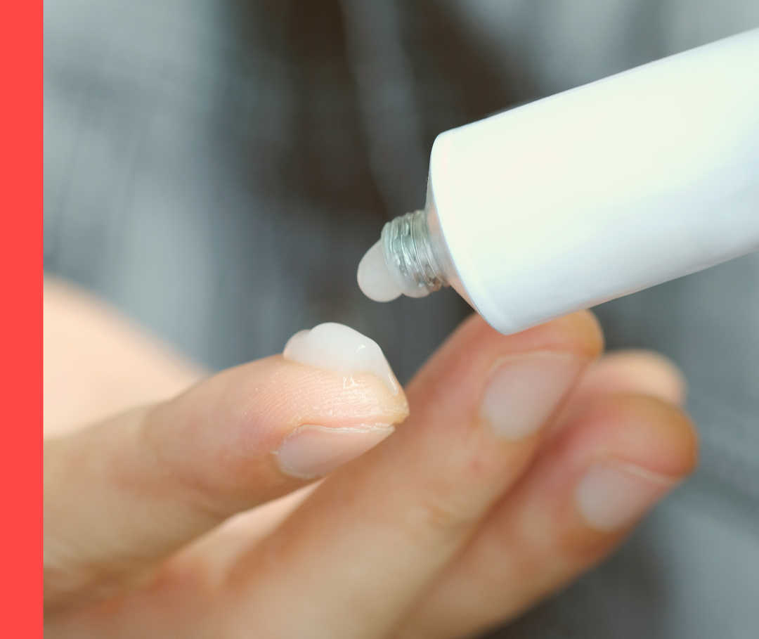 Topische Behandlung mit Creme Nahaufnahme eines Fingers mit Cremeklecks und einer geöffneten Cremetube.