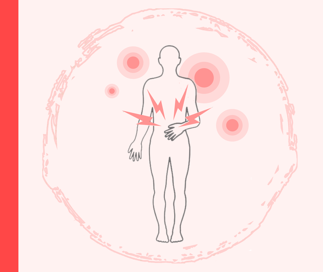 Psoriasis: Persönliche Trigger Umriss einer Person mit Blitzen im Bauchbereich.
