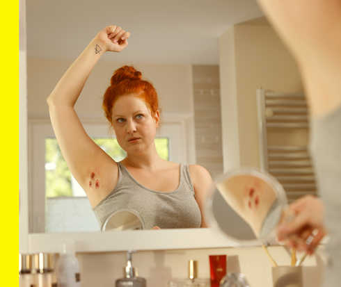 Eine Person schaut in den Spiegel und betrachtet die geröteten Hautstellen in ihrer Armbeuge.