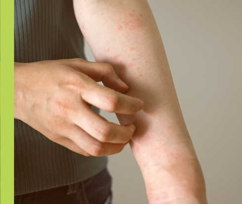 Eine Person kratzt sich am linken Unterarm.