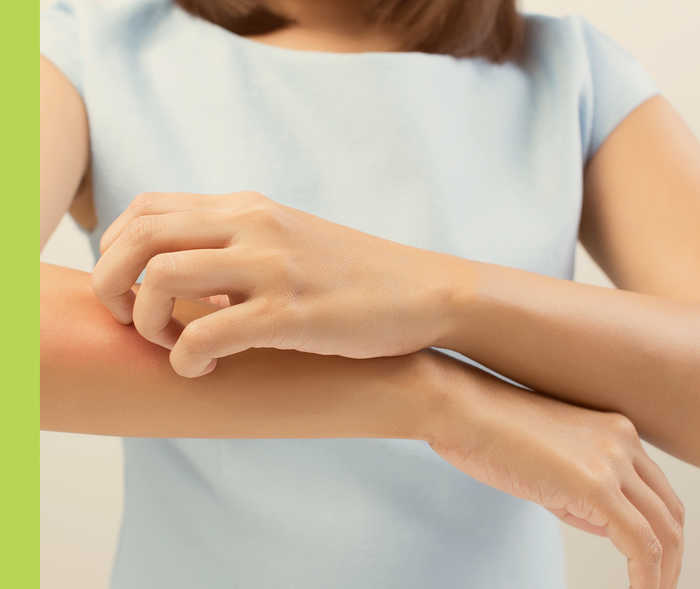 Eine linke Hand kratzt am rechten Unterarm.