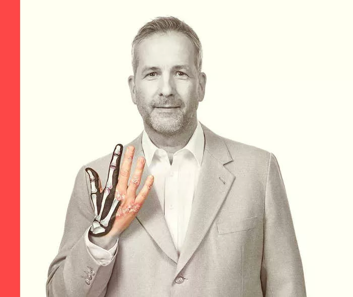 Ein Mann im Businessanzug hält seine rechte Hand hoch und spreizt die Finger. Zwei Finger sind grafisch als Knochen dargestellt.