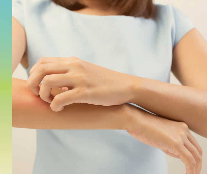 Eine linke Hand kratzt am rechten Unterarm.