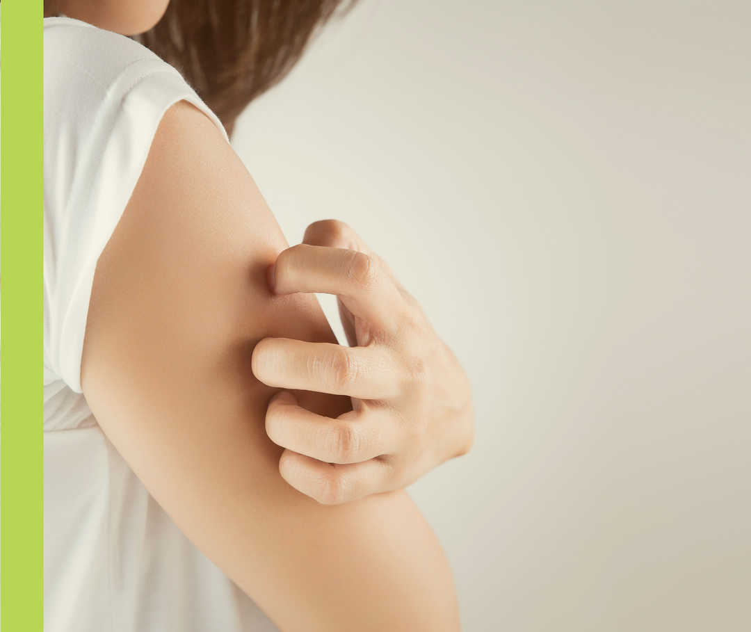 Eine Frau kratzt ihren rechten Oberarm.