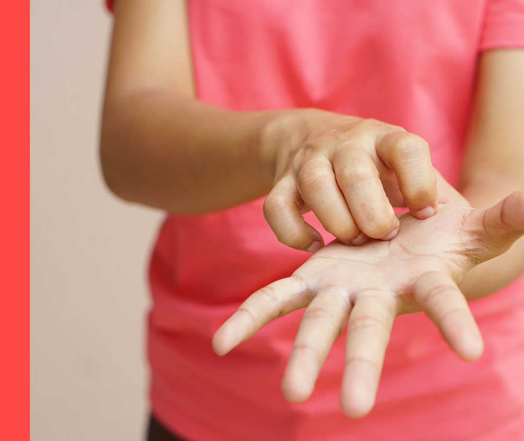 Kind im pinkfarbenen T-Shirt kratzt sich am Handgelenk.
