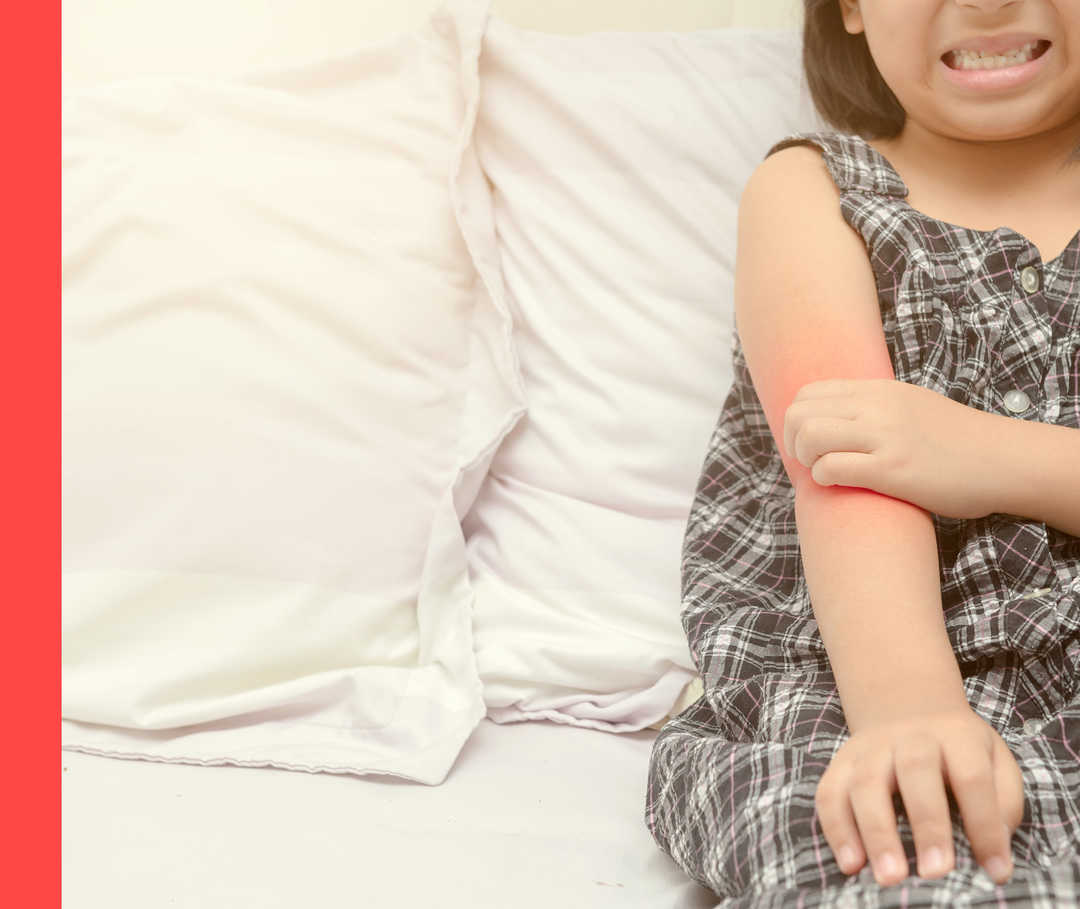 Mädchen in einem karierten Kleid kratzt sich am Arm.