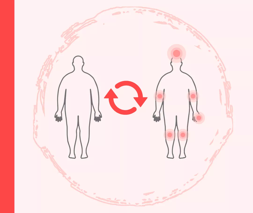 Übergewicht und Psoriasis-Symptome Grafik, die die Umrisse zweier übergewichtiger Personen zeigt. Bei der rechten Person sind Gelenkbereiche und der Kopf orange markiert. Zwischen den Personen befindet sich ein Kreislaufsymbol.