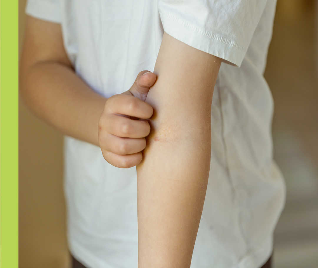 Eine Person kratzt sich mit der rechten Hand an der Innenseite des linken Ellenbogens.