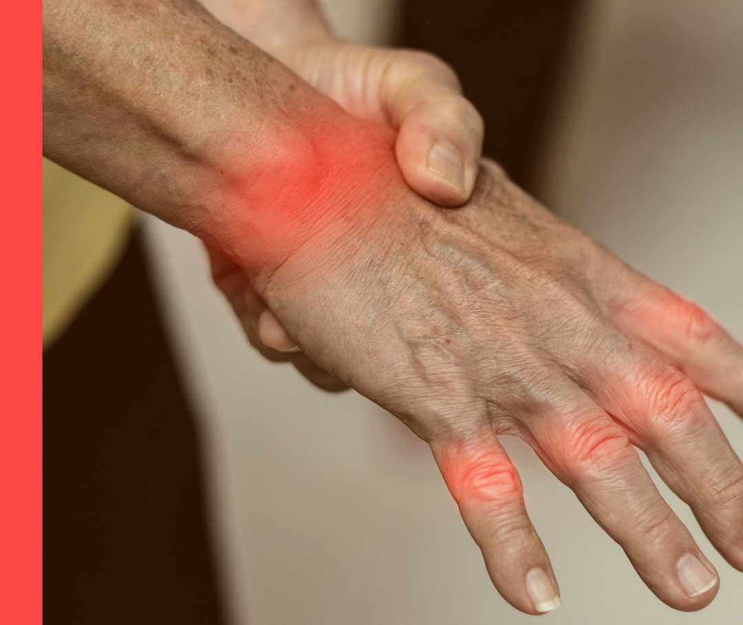 Eine Person greift sich an das rechte Handgelenk. Hand- und Fingergelenke sind symbolisch gerötet. 