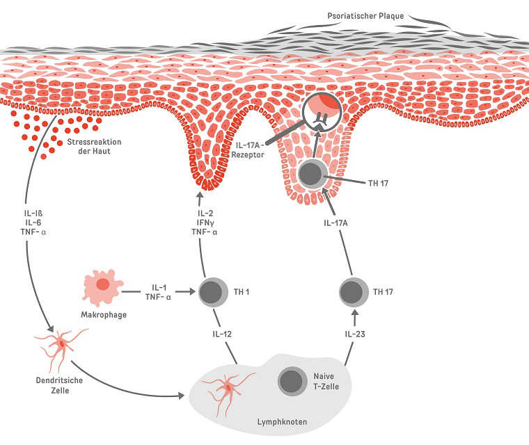 Genaue Darstellung des Entzündungsprozesses Infografik mit schematischer Darstellung der Haut und verschiedenen Zelltypen, die unterschiedliche Botenstoffe produzieren und verschiedene Rezeptoren tragen.