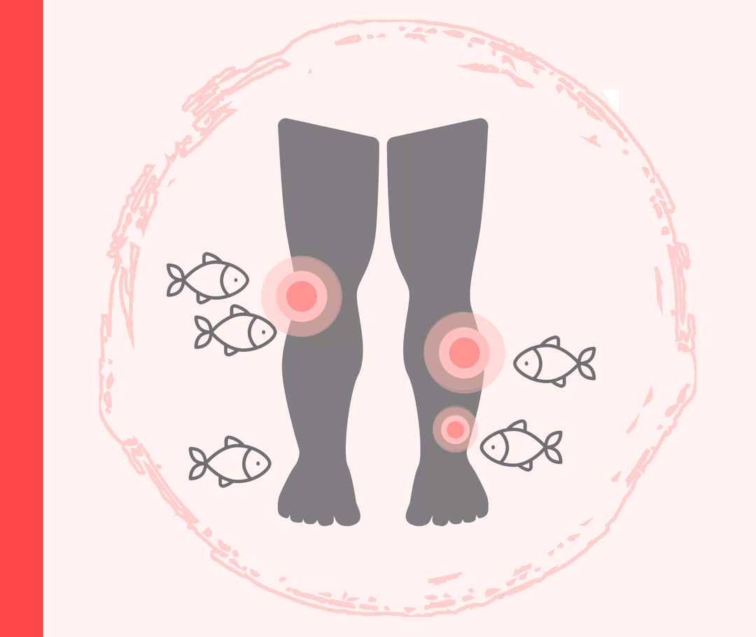 Grafik zweier Beine, die von Fischen umgeben sind. Die Beine haben orangene Markierungen, die die Schuppenflechte symbolisieren sollen.