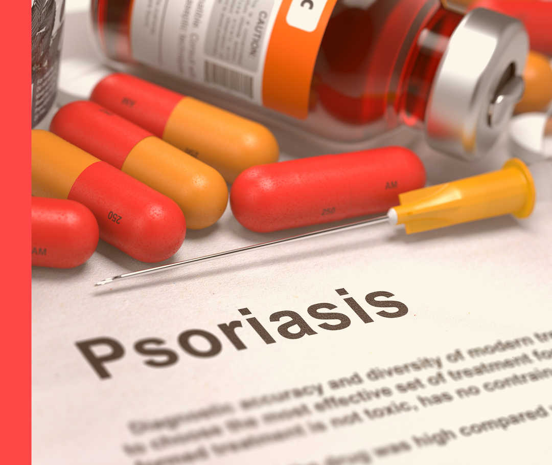 Eine aufgezogene Spritze und mehrere Tabletten liegen auf einem weißen Blatt mit der Aufschrift „Psoriasis“.