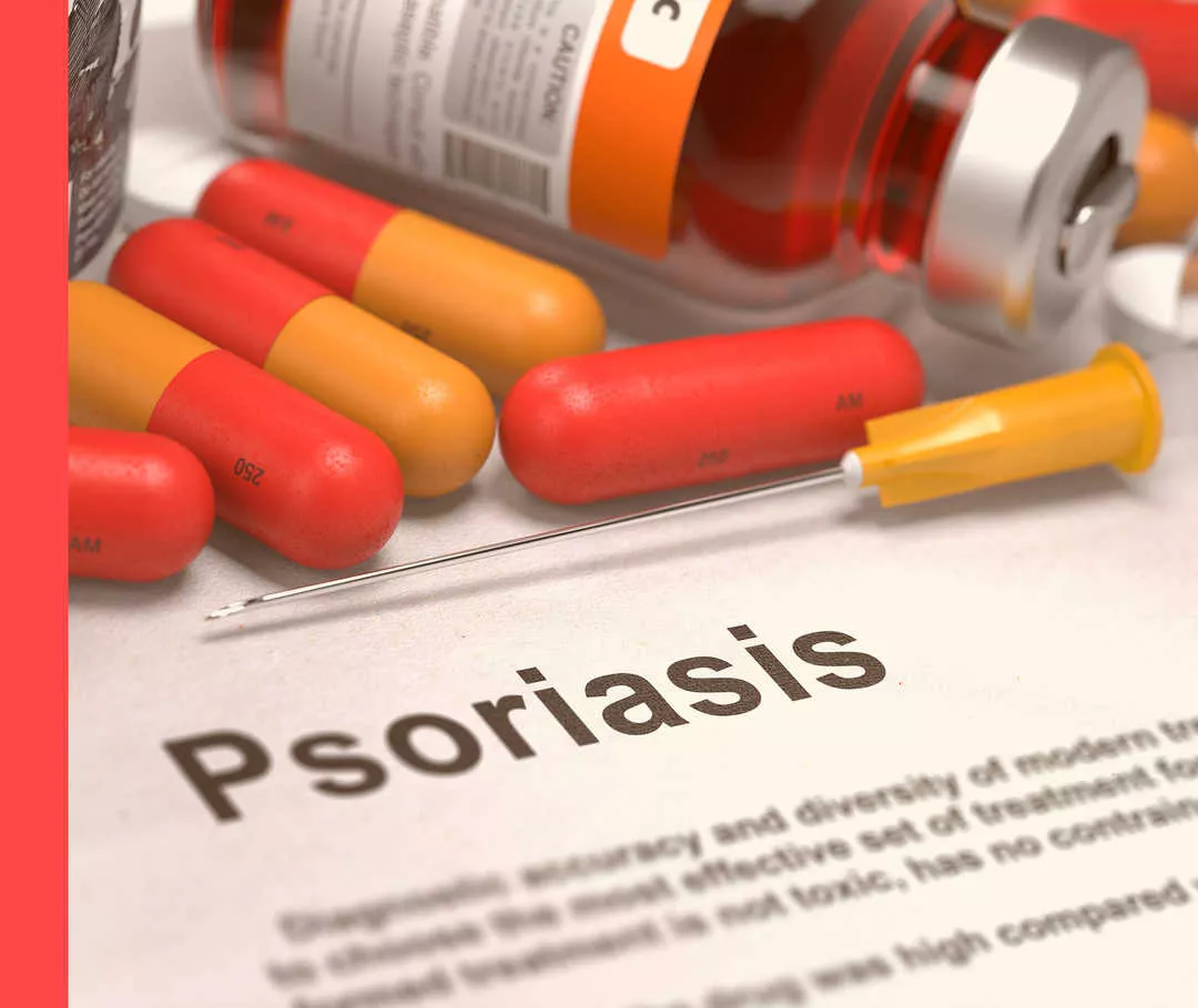 Systemische Behandlung bei Psoriasis Eine aufgezogene Spritze und mehrere Tabletten liegen auf einem weißen Blatt mit der Aufschrift „Psoriasis“.