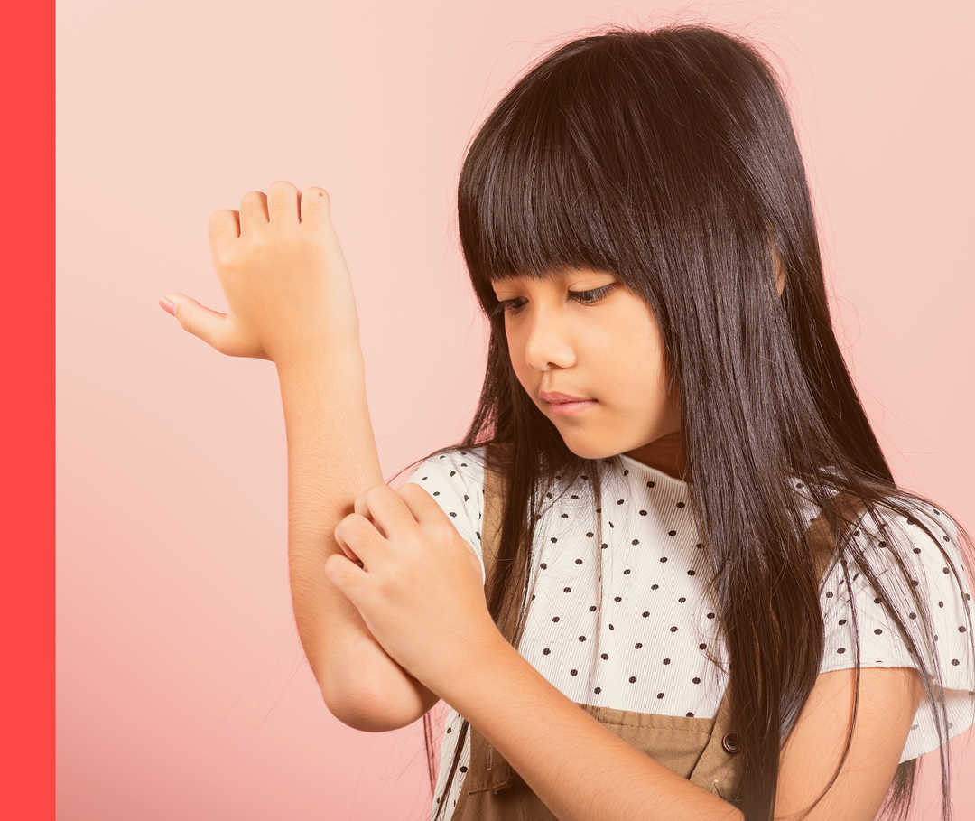 Ein kleines Mädchen kratzt sich am Unterarm.