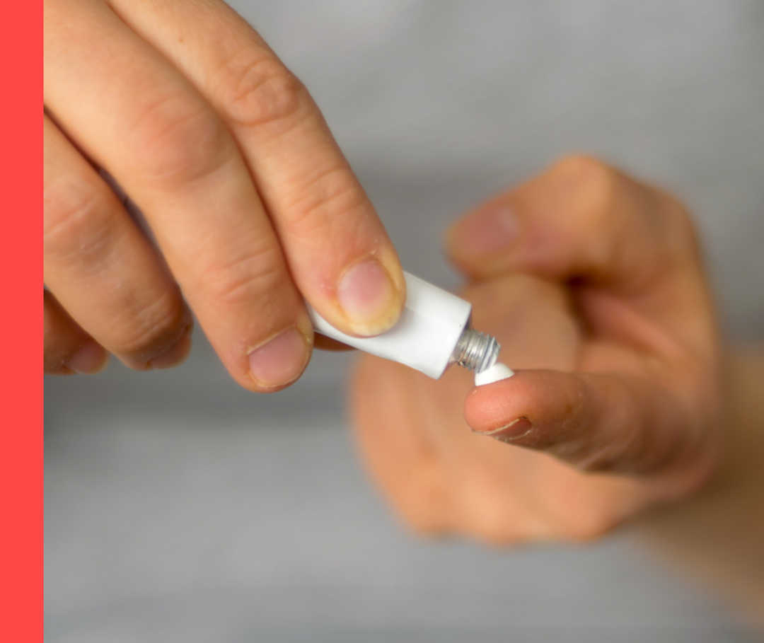 Eine Person drückt Creme aus einer Tube auf die Fingerspitzen ihrer linken Hand.